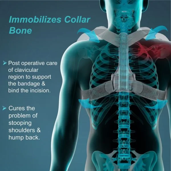 Tynor Clavicle Brace